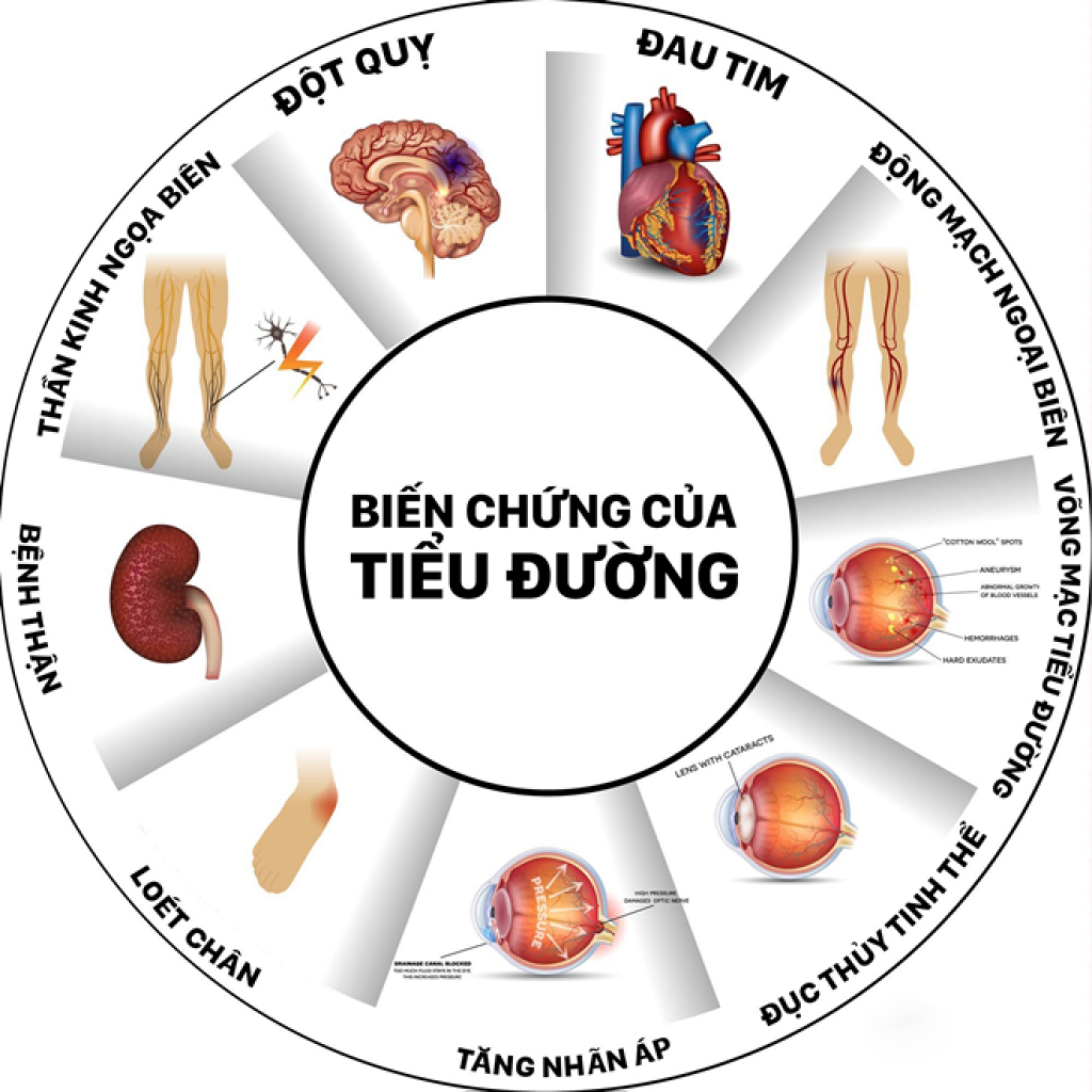 Cách hạn chế biến chứng của bệnh tiểu đường