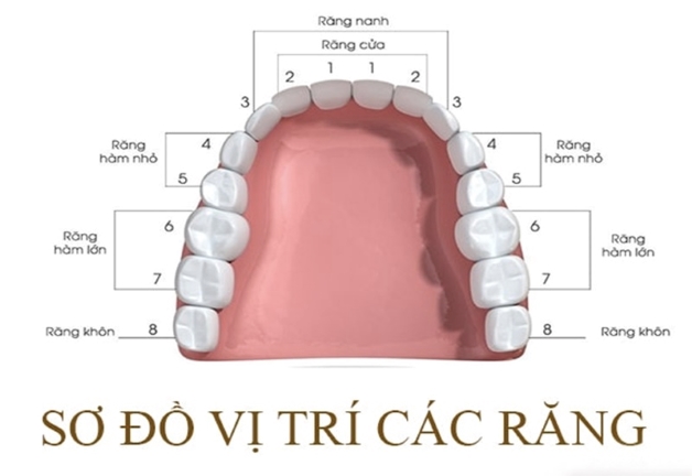 Cách khắc phục khi bị mất 4 răng hàm