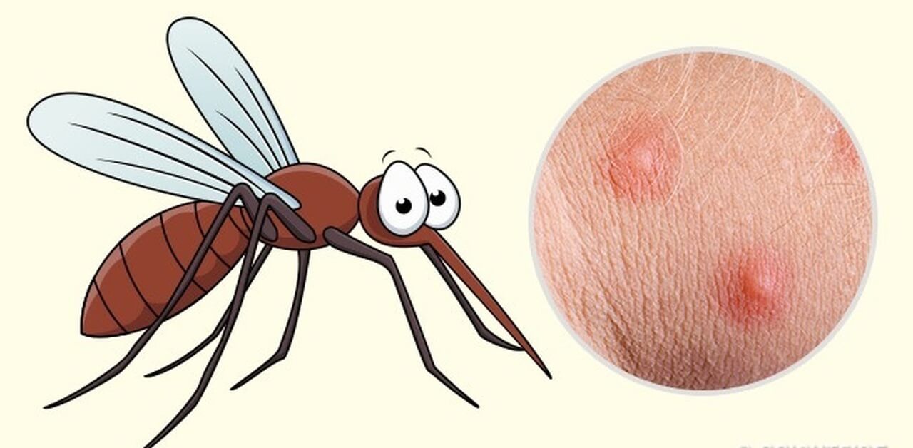 Cách nào phân biệt rõ sốt xuất huyết và sốt virus