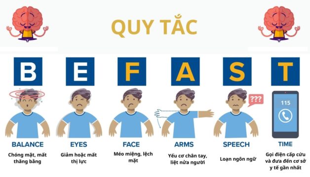 Cách nhận biết bệnh đột quỵ thông qua quy tắc BE FAST