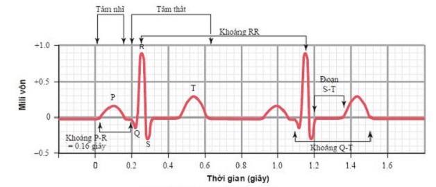 Cách nhận biết các chỉ số điện tâm đồ bình thường