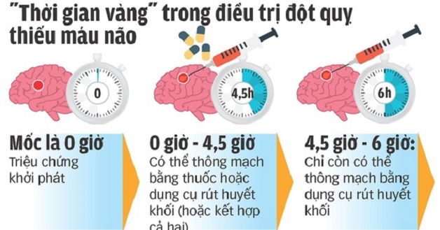 Cách trị đột quỵ nhồi máu não cấp bằng thuốc tiêu sợi huyết