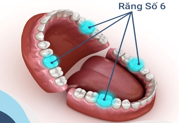 Cách xử lý triệt để khi bị sâu răng cấm