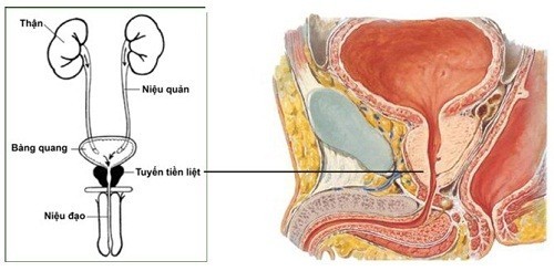 Cách xử trí u xơ tuyến tiền liệt