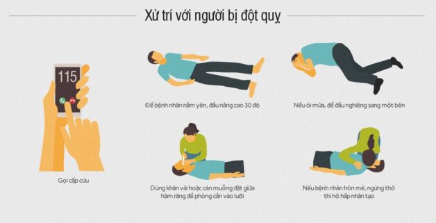 Cần xử trí thế nào khi cơn đột quỵ xảy ra?