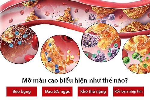 Cảnh báo 4 triệu chứng bệnh máu nhiễm mỡ