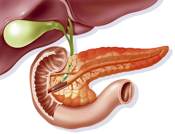 Cảnh báo: Viêm tụy cấp nặng và nguy cơ gây tử vong cực cao