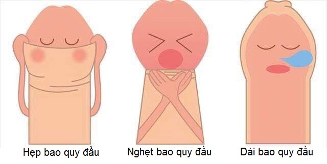 Cắt bao quy đầu trẻ em khi nào cần thực hiện?