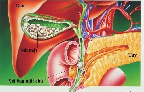 Cắt túi mật có ảnh hưởng đến sức khỏe không?