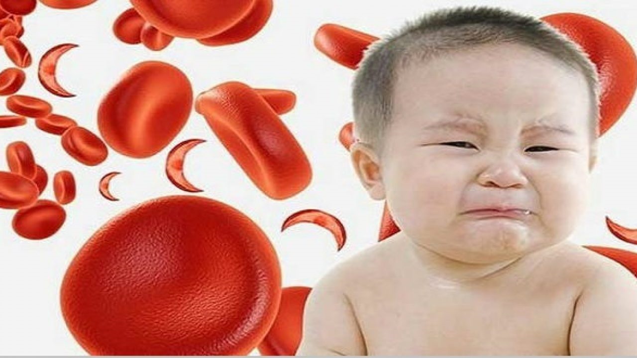 Cha mẹ cần biết: Nguyên nhân và dấu hiệu thiếu máu ở trẻ em