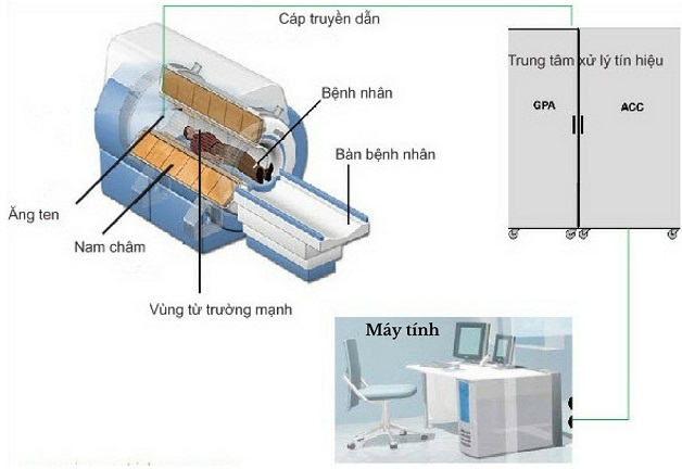 Chi phí chụp cộng hưởng từ bao nhiêu tiền?