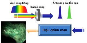 Chi phí nội soi dạ dày đại tràng với công nghệ NBI 5P