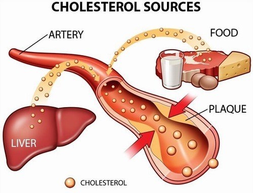 Chỉ số cholesterol là gì? bao nhiêu là hợp lý