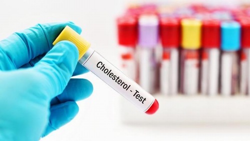 Chỉ số hdl cholesterol là gì? nhiều người băn khoăn