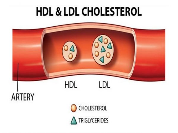 Chỉ số LDL cholesterol là gì?làm tăng nguy cơ mắc bệnh tim mạch