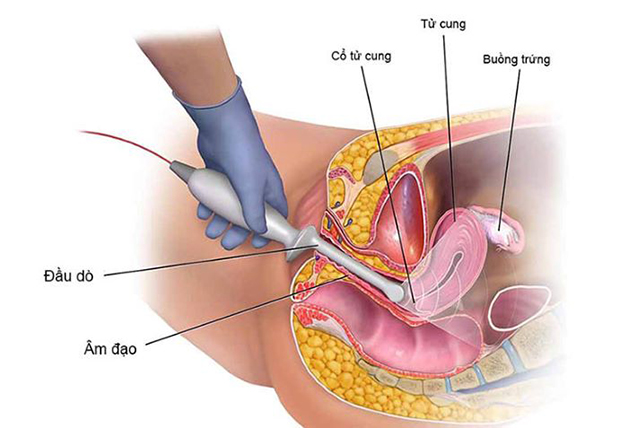 Chỉ số xét nghiệm ung thư cổ tử cung qua xét nghiệm máu