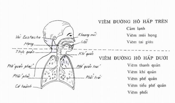 Chi tiết bệnh nhiễm khuẩn hô hấp cấp tính ở trẻ em