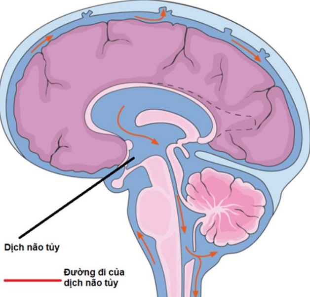 Chọc dò dịch não tủy không đáng sợ như nhiều người nghĩ