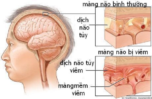 Chọc dò dịch não tủy không đáng sợ như nhiều người nghĩ