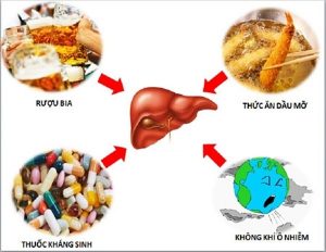 Chữa bệnh viêm gan nguyên nhân nào gây bệnh viêm gan