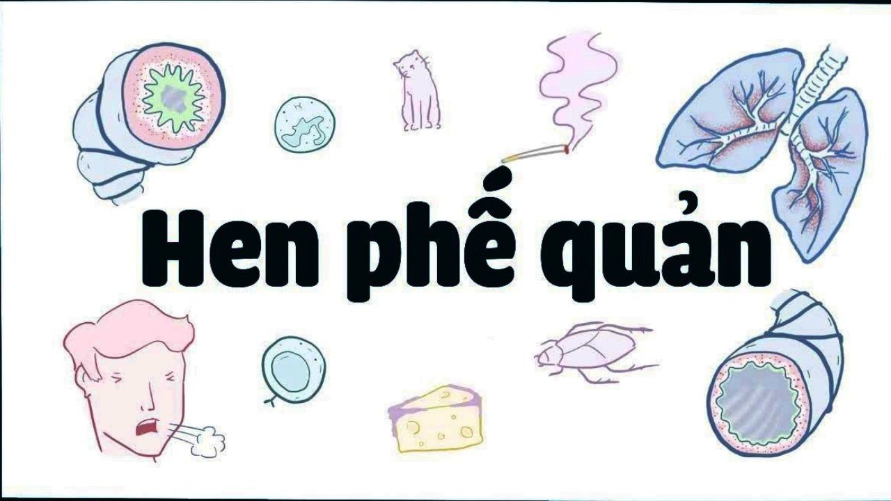 Chữa hen phế quản dịp Tết và những lưu ý quan trọng cần biết