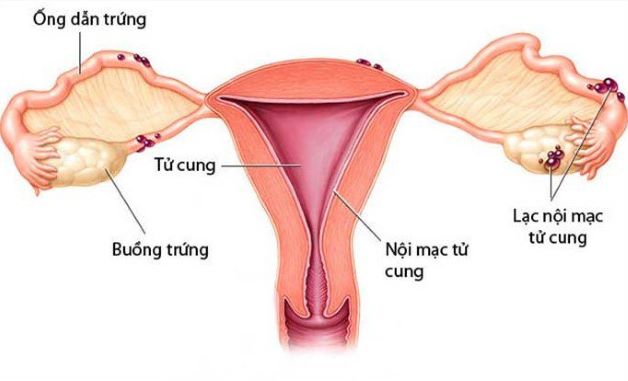 Chửa ngoài dạ con có nguy hiểm không? Có điều trị được không?