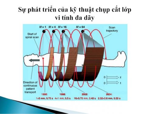 Chụp cắt lớp là gì?