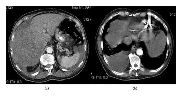 Chụp CT có thuốc cản quang và những điều bạn chưa biết