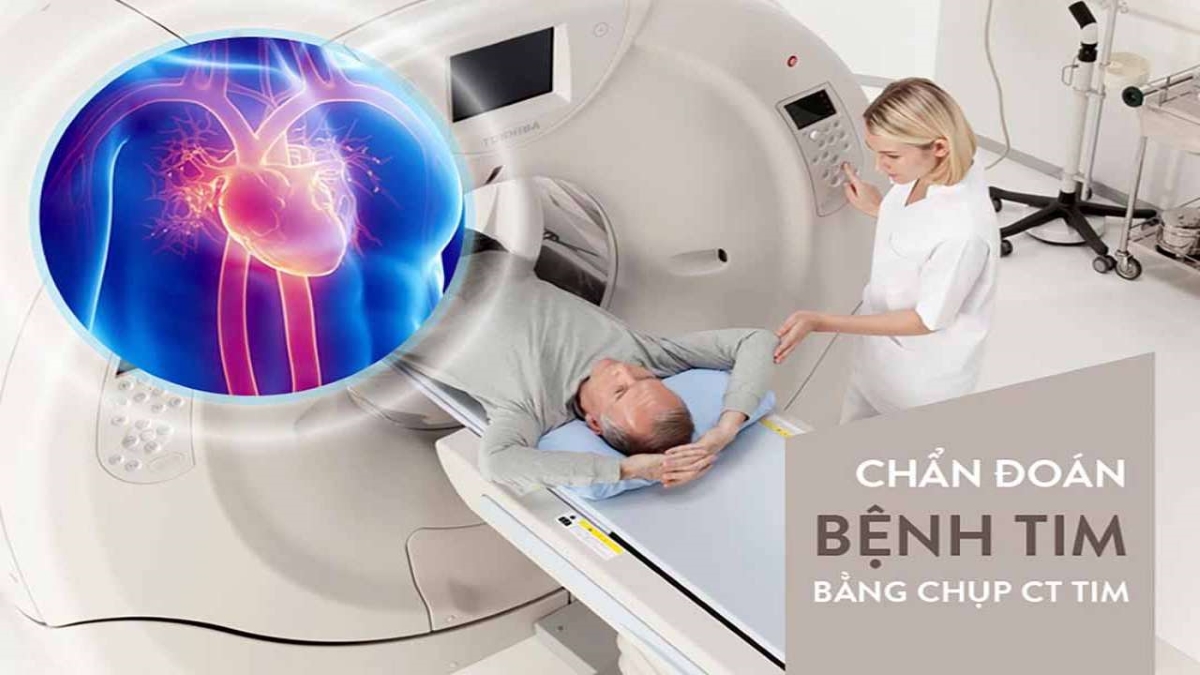 Chụp CT mạch vành – chìa khóa trong điều trị bệnh động mạch vành