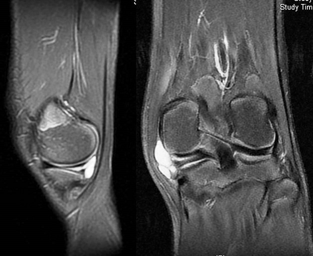 Chụp MRI đầu gối ở đâu tốt? Những tiêu chí lựa chọn