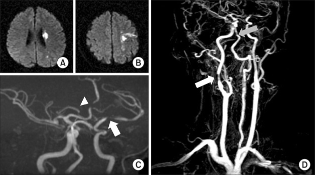 Chụp MRI là gì? Những ưu điểm của phương pháp này