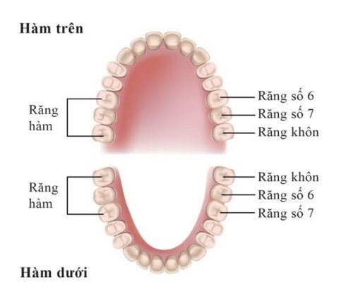 Có cần thiết phải nhổ răng hàm không?