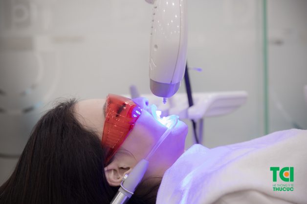 Công nghệ tẩy trắng răng Laser Whitening là gì?