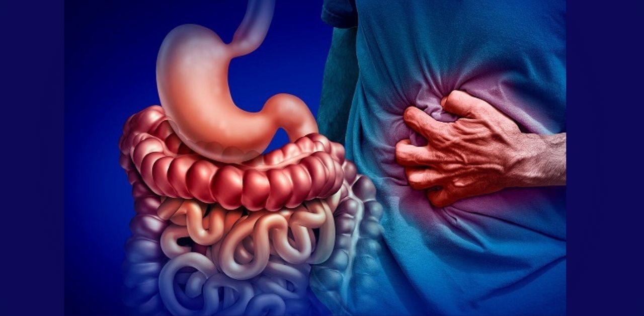 Crohn bệnh học: Nguyên nhân, triệu chứng và điều trị