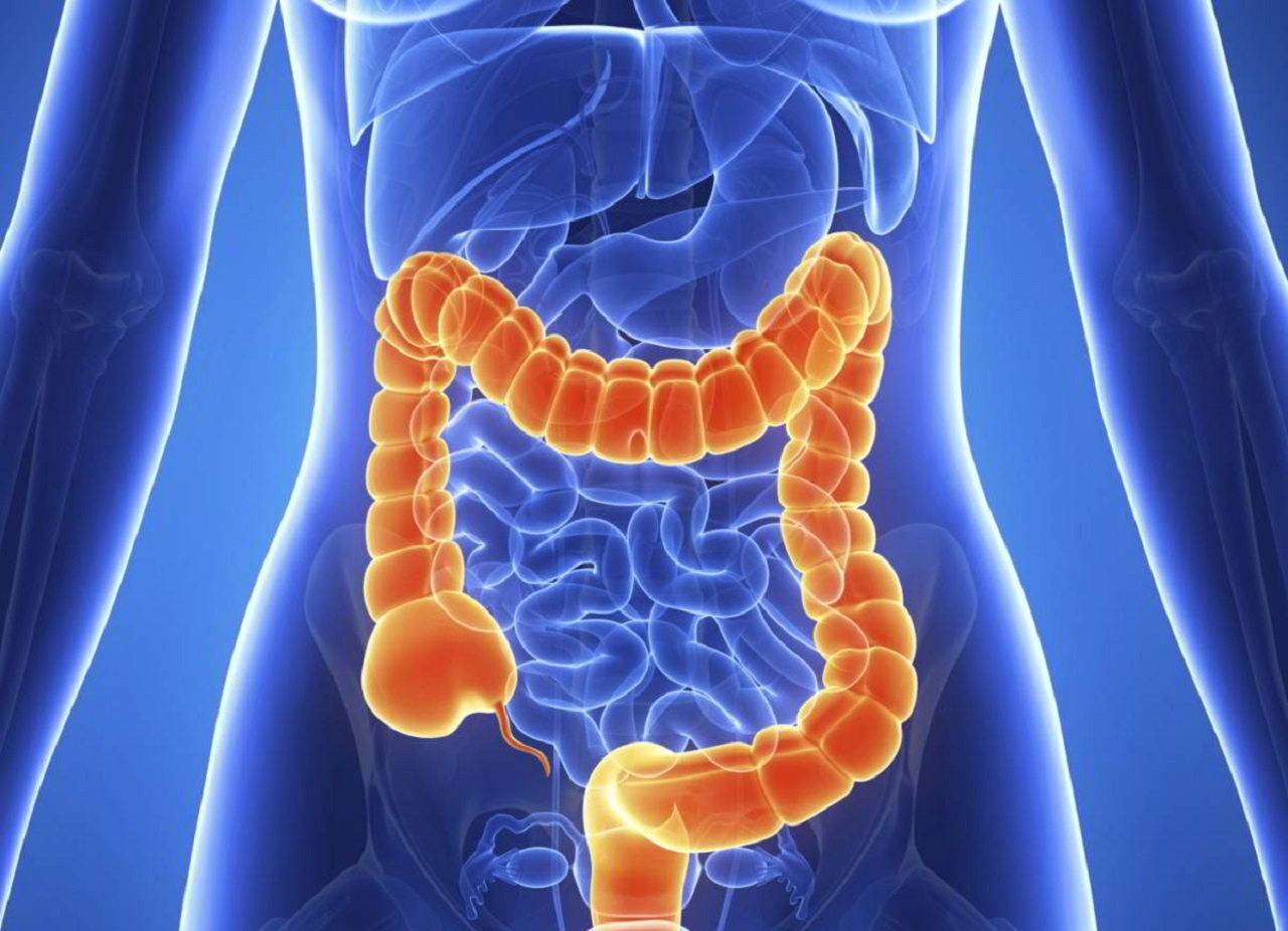 Crohn là bệnh gì? Các kiến thức không thể bỏ qua