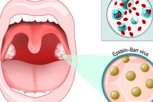 Cung cấp kiến thức về sàng lọc ung thư vòm họng