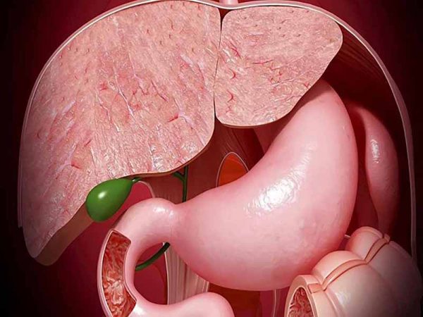 Đa polyp túi mật có nguy hiểm không? Có cần phải mổ không?