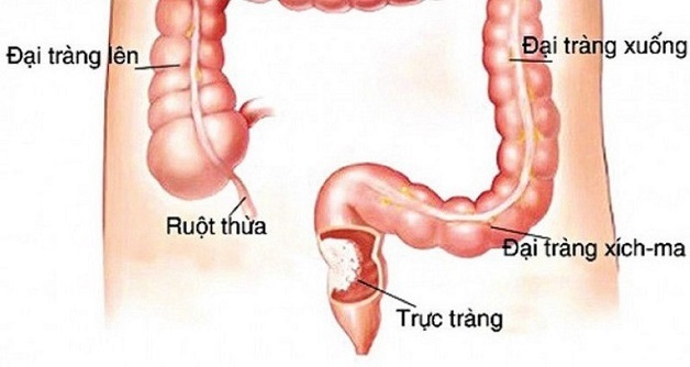 Đại tràng là gì? Cấu tạo và chức năng đại tràng