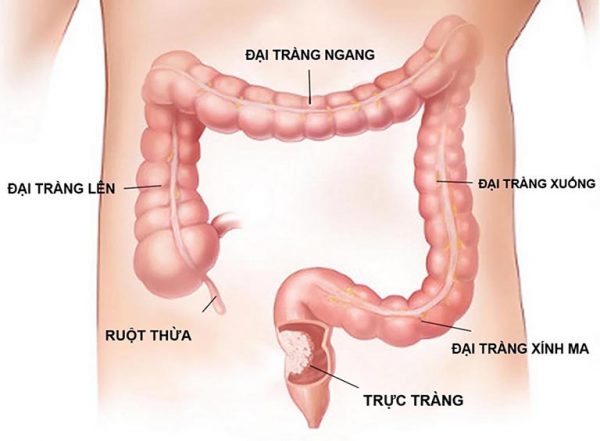 Đại trực tràng là gì? Những thông tin cơ bản cần biết