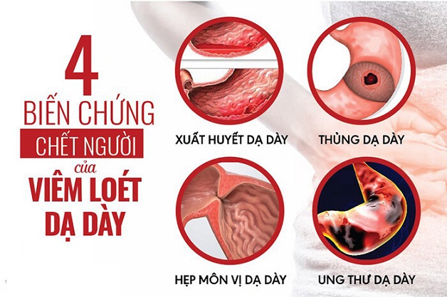 Đánh giá viêm dạ dày có nguy hiểm không?