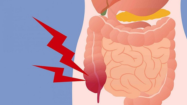 Đau bụng viêm đại tràng và những điều cần lưu ý 