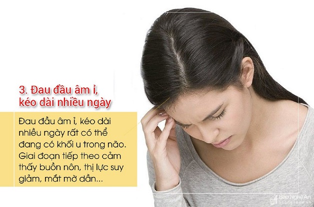 Đau đầu 1 bên chớ nên coi thường kẻo bệnh nặng