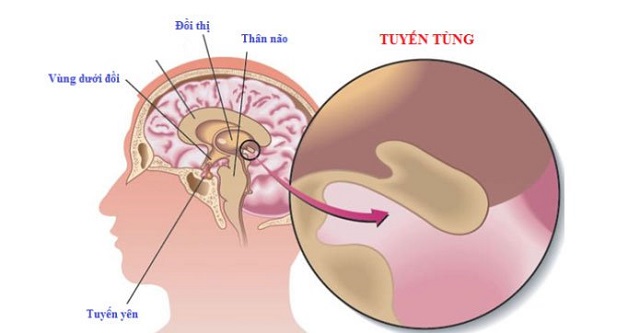 Đau đầu vì thiếu ngủ lâu ngày phải cẩn thận