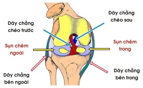 Đau dây chằng đầu gối do nhiều nguyên nhân gây ra