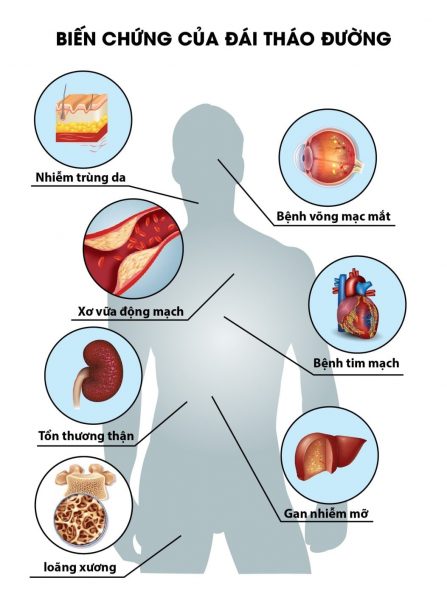 Dấu hiệu bệnh tiểu đường – đề phòng các biến chứng nguy hiểm