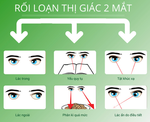 Dấu hiệu bị rối loạn thị giác và cách chữa hiệu quả?