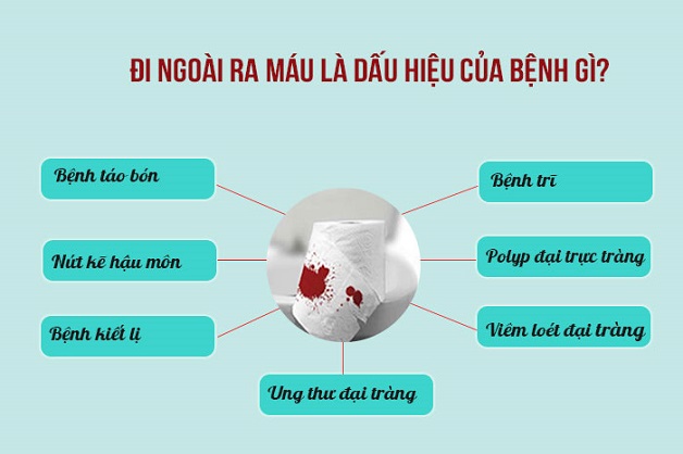 Dấu hiệu nhận biết ung thư đại tràng ngay từ giai đoạn sớm