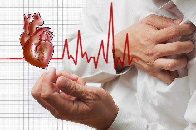 Dấu hiệu nhồi máu cơ tim trên ECG là gì?