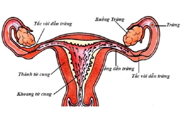 Dấu hiệu tắc ống dẫn trứng, nguyên nhân và cách xử lý