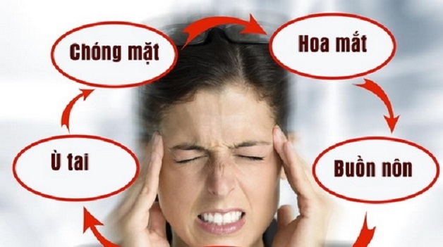 Đau nửa đầu chóng mặt buồn nôn chớ chủ quan